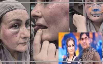 تشدد کیس :اسٹیج اداکارہ نرگس اور شوہر ماجد بشیر کے درمیان صلح ہوگئی