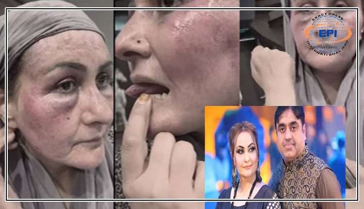 تشدد کیس :اسٹیج اداکارہ نرگس اور شوہر ماجد بشیر کے درمیان صلح ہوگئی